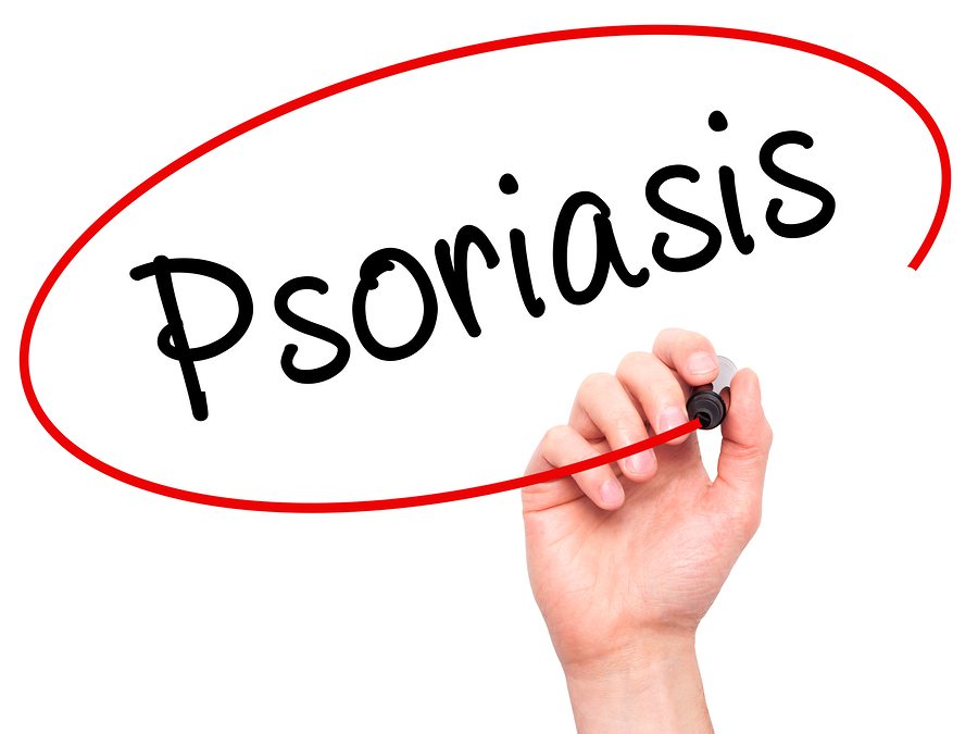 Home Health Care in Beaver PA: Psoriasis And A Low Immune System